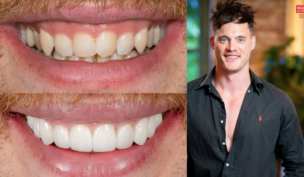 Married At First Sight, MAFS