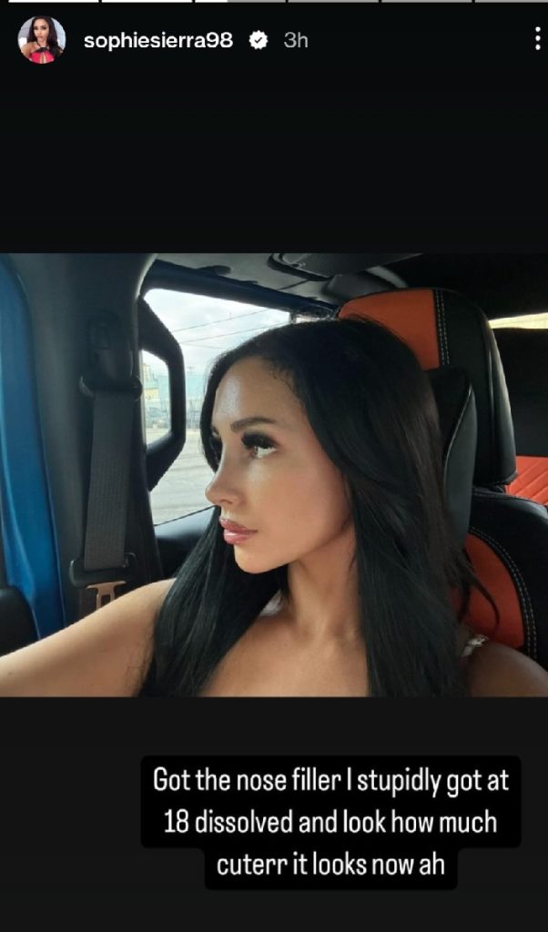 90 DAY FIANCE SOPHIE NOSE