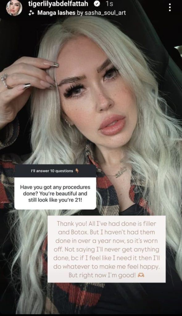 90 DAY FIANCE TIGERLILY SURGERY 