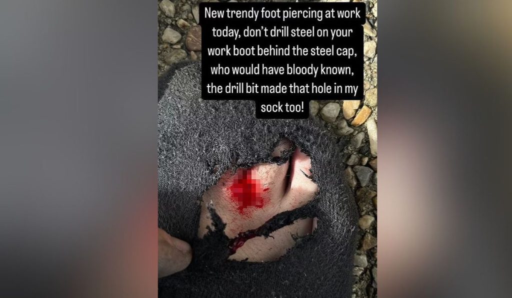 Married At First Sight - Ryan Gallagher Foot Injury