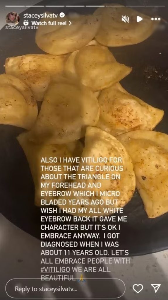 90 DAY FIANCE STACEY HEALTH