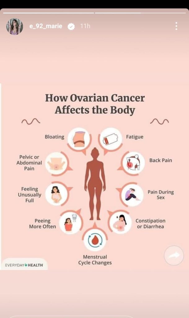 90 DAY FIANCE LIZ WOODS CANCER